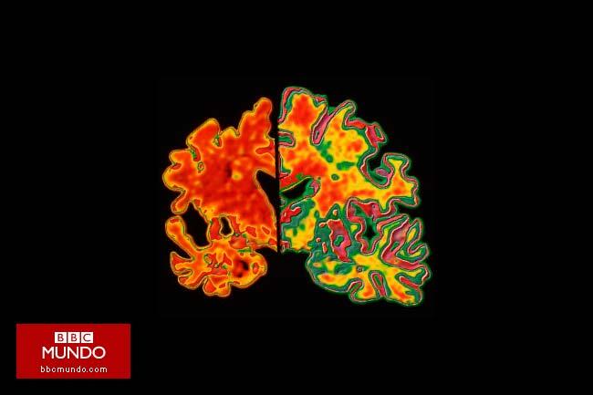 Los antioxidantes del té verde y vino tinto contra el Alzheimer