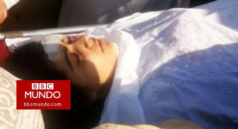Conmoción por ataque a joven que recibió un disparo en la cabeza por criticar al Talibán