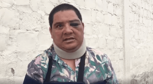 Candidato del Verde en Coahuila golpea a su excoordinador; le ocasiona fracturas y un esguince