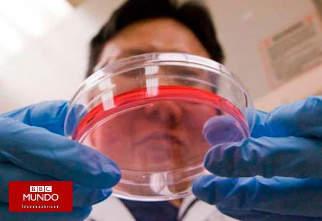 Confirman existencia de células madre cancerosas