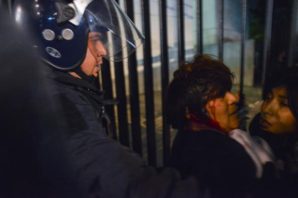 Madre de familia golpeada por policía da su testimonio #1dmx