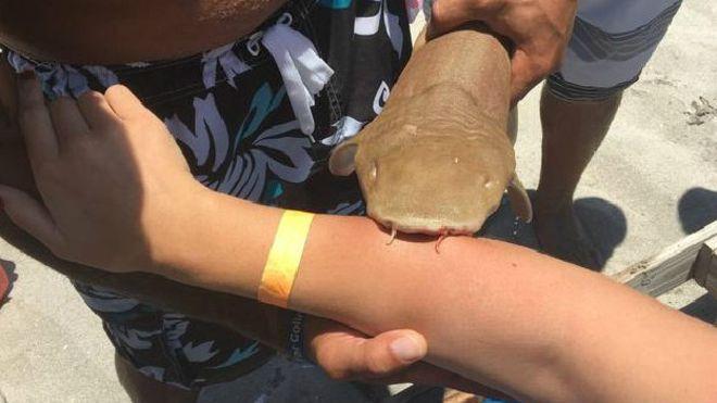 La mujer que fue al hospital con un tiburón pegado al brazo
