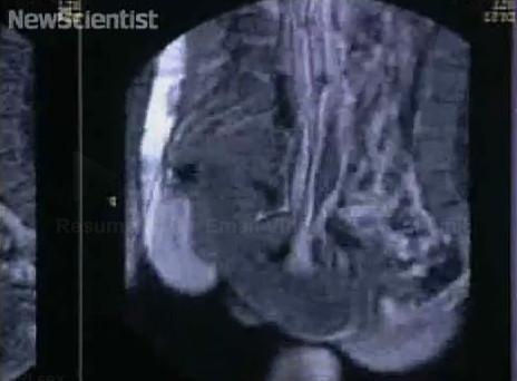 El acto sexual desde dentro