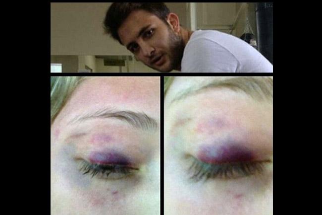 Nieto de Murillo Karam acepta haber golpeado a hija del titular del Cisen