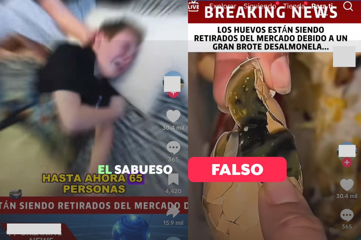 No, la salmonelosis no provoca ataques epilépticos