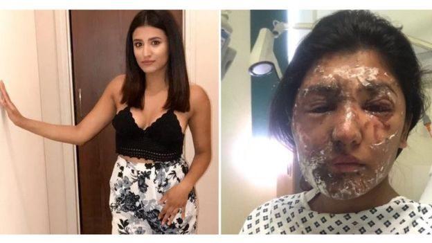 Resham Khan, la joven que conquistó redes sociales tras ser atacada  con ácido en Londres