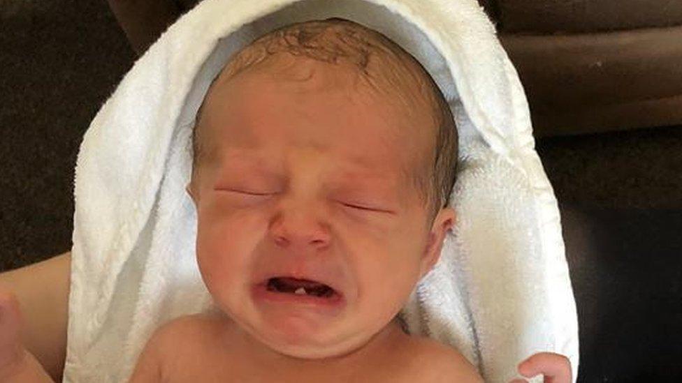 “Es la paciente más joven que hemos visto”: la bebé de 12 días a la que le extrajeron un diente