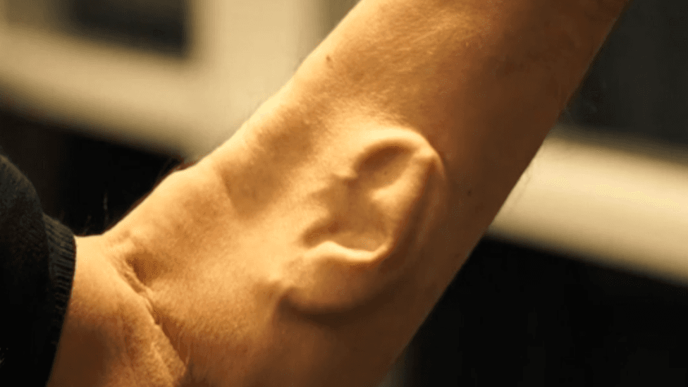 Una oreja implantada y cuernos bajo la piel: cómo son los “bodyhackers” más extremos