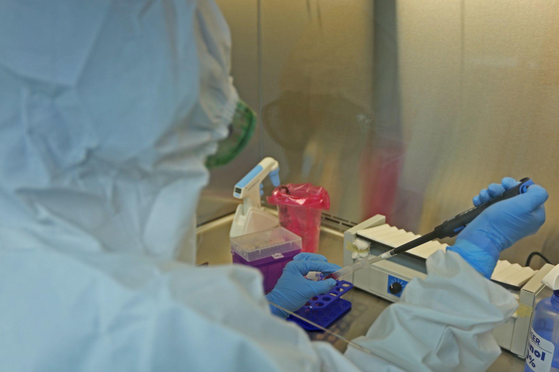 Autoridades de Jalisco reportan caso de viruela del mono, el segundo en el país detectado este año