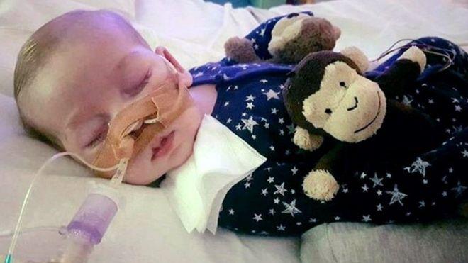 Muere Charlie Gard, el bebé cuya rara enfermedad enfrentó a sus padres con la Justicia británica