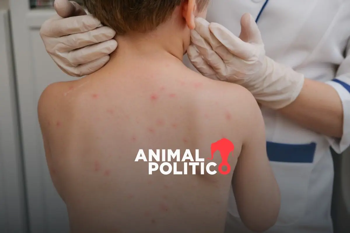 Con brote aún activo, México afronta revisión de la OPS sobre control del sarampión